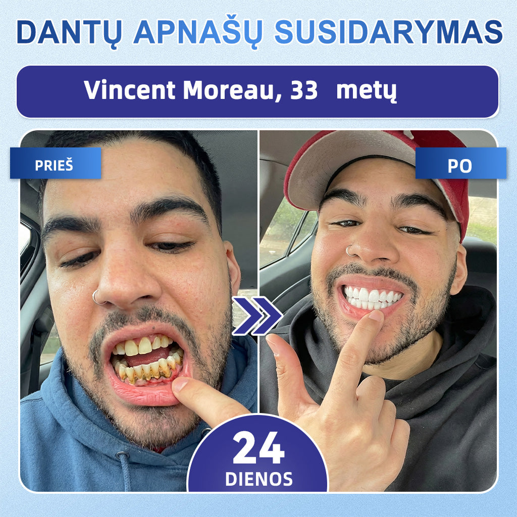 GarageLine®🦷 „Tideglusib“ dantų ir dantenų „NanoRepair“ tirpios balinančios juostelės ✨ (Padeda atkurti dantų audinius ir sumažinti dantenų diskomfortą bei kitas dažnas burnos ertmės problemas)