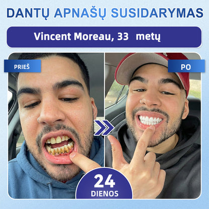 GarageLine®🦷 „Tideglusib“ dantų ir dantenų „NanoRepair“ tirpios balinančios juostelės ✨ (Padeda atkurti dantų audinius ir sumažinti dantenų diskomfortą bei kitas dažnas burnos ertmės problemas)