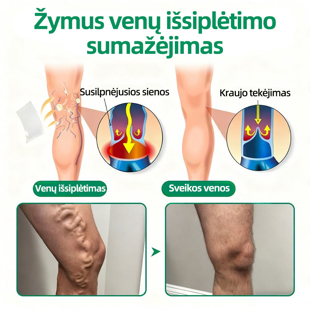 🇱🇹👨‍⚕️✅Healrize® VeinTarget mikroadatų pleistras⚡Nedelsiant palengvėja, ilgalaikiai rezultatai🪗