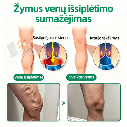 🇱🇹👨‍⚕️✅Healrize® VeinTarget mikroadatų pleistras⚡Nedelsiant palengvėja, ilgalaikiai rezultatai🪗