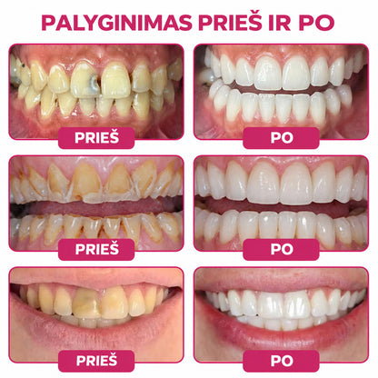⭐👨‍⚕️🦷𝐇𝐄𝐀𝐓𝐖𝐎𝐋𝐅® 𝐃𝐞𝐧𝐏𝐞𝐫𝐦 – 𝐓𝐞𝐫𝐦é𝐬𝐳𝐞𝐭𝐞𝐬 𝐟𝐨𝐠𝐳𝐨𝐦á𝐧𝐜-𝐭ö𝐥𝐭ő 𝐠é𝐥 𝐚 𝐟𝐨𝐠𝐬𝐳𝐮𝐯𝐚𝐬𝐨𝐝á𝐬 𝐡𝐞𝐥𝐲𝐫𝐞á𝐥𝐥í𝐭á𝐬á𝐫𝐚🐟5️⃣