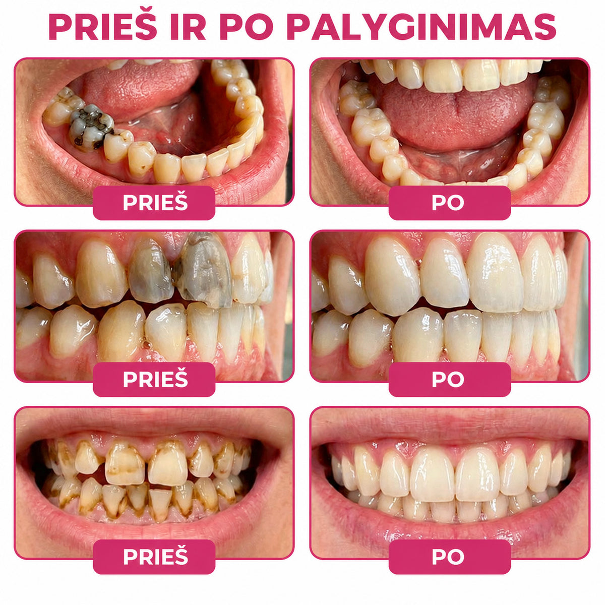 ⭐👨‍⚕️🦷𝐇𝐄𝐀𝐓𝐖𝐎𝐋𝐅® 𝐃𝐞𝐧𝐏𝐞𝐫𝐦 – 𝐓𝐞𝐫𝐦é𝐬𝐳𝐞𝐭𝐞𝐬 𝐟𝐨𝐠𝐳𝐨𝐦á𝐧𝐜-𝐭ö𝐥𝐭ő 𝐠é𝐥 𝐚 𝐟𝐨𝐠𝐬𝐳𝐮𝐯𝐚𝐬𝐨𝐝á𝐬 𝐡𝐞𝐥𝐲𝐫𝐞á𝐥𝐥í𝐭á𝐬á𝐫𝐚🐟5️⃣