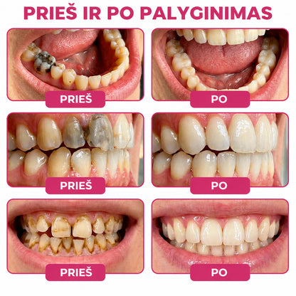 ⭐👨‍⚕️🦷𝐇𝐄𝐀𝐓𝐖𝐎𝐋𝐅® 𝐃𝐞𝐧𝐏𝐞𝐫𝐦 – 𝐓𝐞𝐫𝐦é𝐬𝐳𝐞𝐭𝐞𝐬 𝐟𝐨𝐠𝐳𝐨𝐦á𝐧𝐜-𝐭ö𝐥𝐭ő 𝐠é𝐥 𝐚 𝐟𝐨𝐠𝐬𝐳𝐮𝐯𝐚𝐬𝐨𝐝á𝐬 𝐡𝐞𝐥𝐲𝐫𝐞á𝐥𝐥í𝐭á𝐬á𝐫𝐚🐟5️⃣